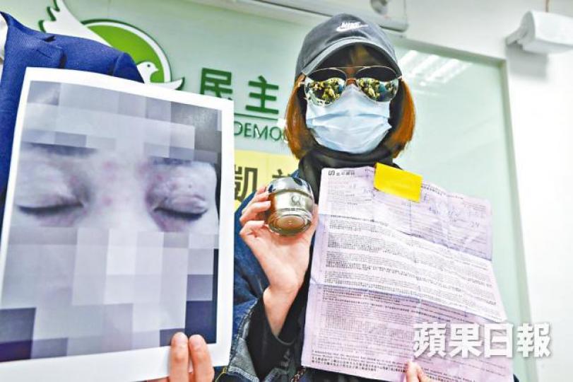 H小姐稱接受首次療程時皮膚刺痛。 H小姐稱接受首次療程時皮膚刺痛。