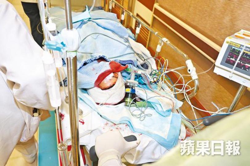 女事主身中多刀重創,送院救治。黎家駒攝疑兇牛仔褲染滿血迹,被警員黑布蒙頭帶走調查。 女事主身中多刀重創,送院救治。黎家駒攝疑兇牛仔褲染滿血迹,被警員黑布蒙頭帶走調查。