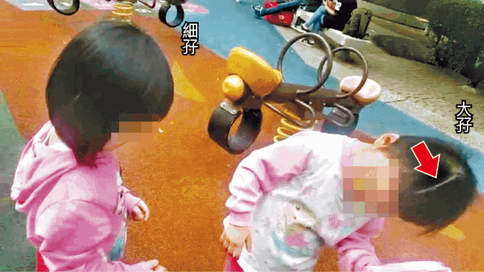 曾被虐待至腦出血的大孖現年5歲,現已康復,但頭部仍留手術疤痕(箭嘴示);旁為其孖生妹妹。 曾被虐待至腦出血的大孖現年5歲,現已康復,但頭部仍留手術疤痕(箭嘴示);旁為其孖生妹妹。
