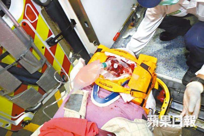 女傷者頭面重創,由救護員送院搶救。事發現場遺下大灘血迹。鄭文輝攝 女傷者頭面重創,由救護員送院搶救。事發現場遺下大灘血迹。鄭文輝攝