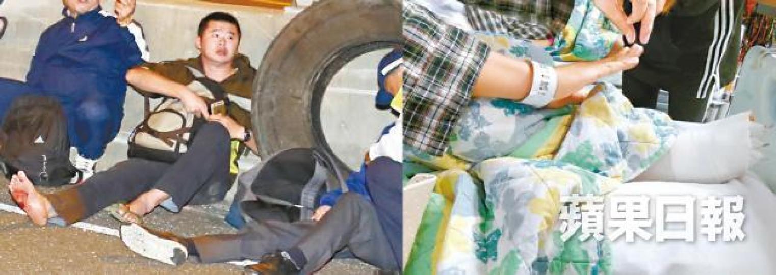 車禍中三隻腳趾骨折的地勤葉宇剛要接受接駁手術,現時日食10多粒藥止痛消炎。上月30日的冠忠旅遊巴車禍造成6死31傷。高塘村村長黃來生在大埔翻巴士意外中受重傷,至今仍未完全康復。 車禍中三隻腳趾骨折的地勤葉宇剛要接受接駁手術,現時日食10多粒藥止痛消炎。上月30日的冠忠旅遊巴車禍造成6死31傷。高塘村村長黃來生在大埔翻巴士意外中受重傷,至今仍未完全康復。