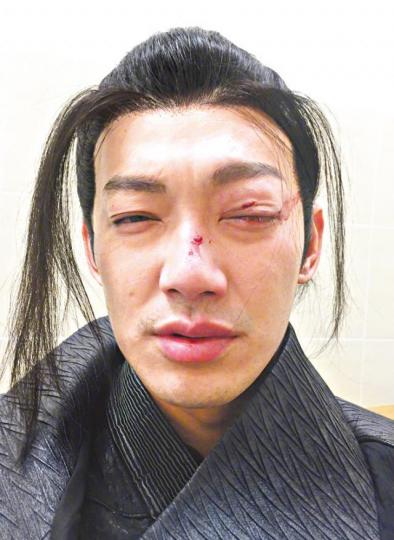 威廉日前拍攝《異瞳神探》時發生意外,俾木劍打傷眼。微博圖片威廉指食得呢行飯,就想堅持做到好。微博圖片吳克群(左)聽見好兄弟威廉受傷後第一句話最怕冇得再拍,大受感動。互聯網圖片威廉(左二)曾是棒棒堂成員,後來轉戰內地拍劇。資料圖片 威廉日前拍攝《異瞳神探》時發生意外,俾木劍打傷眼。微博圖片威廉指食得呢行飯,就想堅持做到好。微博圖片吳克群(左)聽見好兄弟威廉受傷後第一句話最怕冇得再拍,大受感動。互聯網圖片威廉(左二)曾是棒棒堂成員,後來轉戰內地拍劇。資料圖片