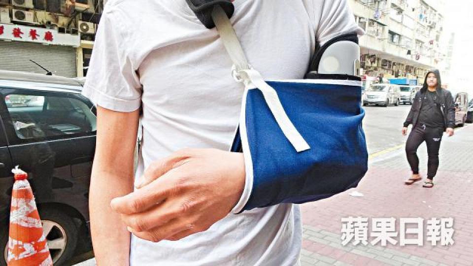 馮先生手部受傷,要停工休養。 馮先生手部受傷,要停工休養。
