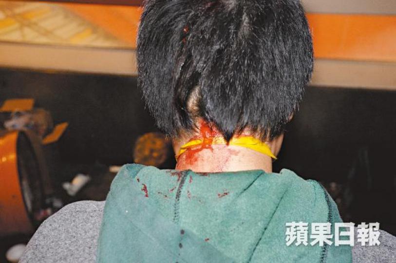 記者當日遭警員打爆頭須縫針。2016年旺角騷亂,記者(箭嘴示)表明身份仍遭警員壓在地毆打。盧偉聰 記者當日遭警員打爆頭須縫針。2016年旺角騷亂,記者(箭嘴示)表明身份仍遭警員壓在地毆打。盧偉聰