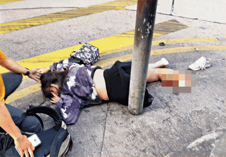 女事主黃曉儀當日被輾過後,右腿要截肢。城巴車長廖淦泓 女事主黃曉儀當日被輾過後,右腿要截肢。城巴車長廖淦泓