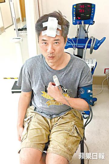邵仲衡笑言收咗利是當係鴻運當頭,會休息兩日再開工。邵仲衡前日被攝影機扑爆額頭,但佢堅持收工後先去醫院。 邵仲衡笑言收咗利是當係鴻運當頭,會休息兩日再開工。邵仲衡前日被攝影機扑爆額頭,但佢堅持收工後先去醫院。