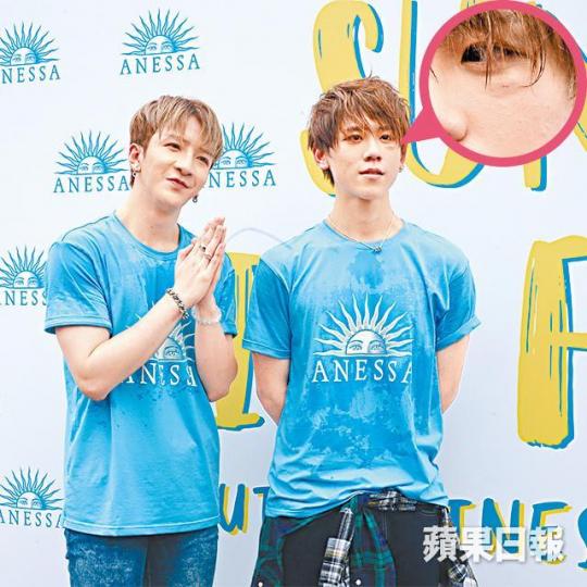 姜濤(右)被Anson Lo撞到眼肚腫起,Anson尷尬道歉。MIRROR完成表演後,姜濤即用濕毛巾敷眼,但Anson Lo唔知整親佢。 姜濤(右)被Anson Lo撞到眼肚腫起,Anson尷尬道歉。MIRROR完成表演後,姜濤即用濕毛巾敷眼,但Anson Lo唔知整親佢。