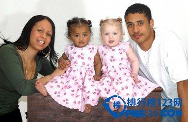 早前英國一對混血雙胎姐妹渡
過1歲生日,剛出生時兩人幾乎
一模一樣,一天天長大,姐膚色
雪白金黃捲髮,碧藍大眼睛，
妹則黑膚色和黑頭髮,黑白膚
色雙胞胎專家説非常罕見,發
生率僅有百萬分之一。...